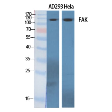 Western blot - FAK Polyclonal Antibody from Signalway Antibody (40917) - Antibodies.com