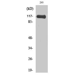Western blot - Hrs Polyclonal Antibody from Signalway Antibody (41035) - Antibodies.com