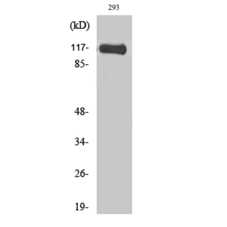 Western blot - Hrs Polyclonal Antibody from Signalway Antibody (41035) - Antibodies.com