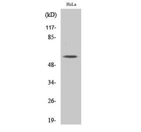 Western blot - MYH Polyclonal Antibody from Signalway Antibody (41193) - Antibodies.com