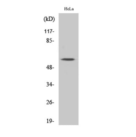 Western blot - MYH Polyclonal Antibody from Signalway Antibody (41193) - Antibodies.com