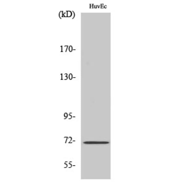 Western blot - NF2 Polyclonal Antibody from Signalway Antibody (41220) - Antibodies.com