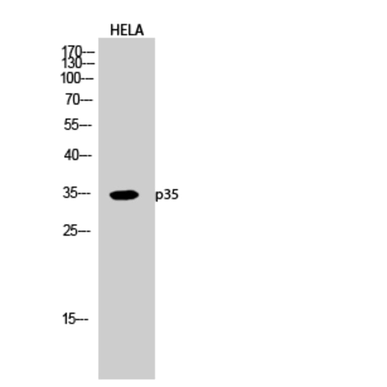 Western blot - p35 Polyclonal Antibody from Signalway Antibody (41304) - Antibodies.com