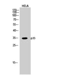 Western blot - p35 Polyclonal Antibody from Signalway Antibody (41304) - Antibodies.com