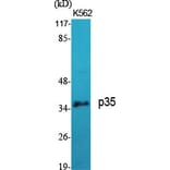 Western blot - p35 Polyclonal Antibody from Signalway Antibody (41304) - Antibodies.com