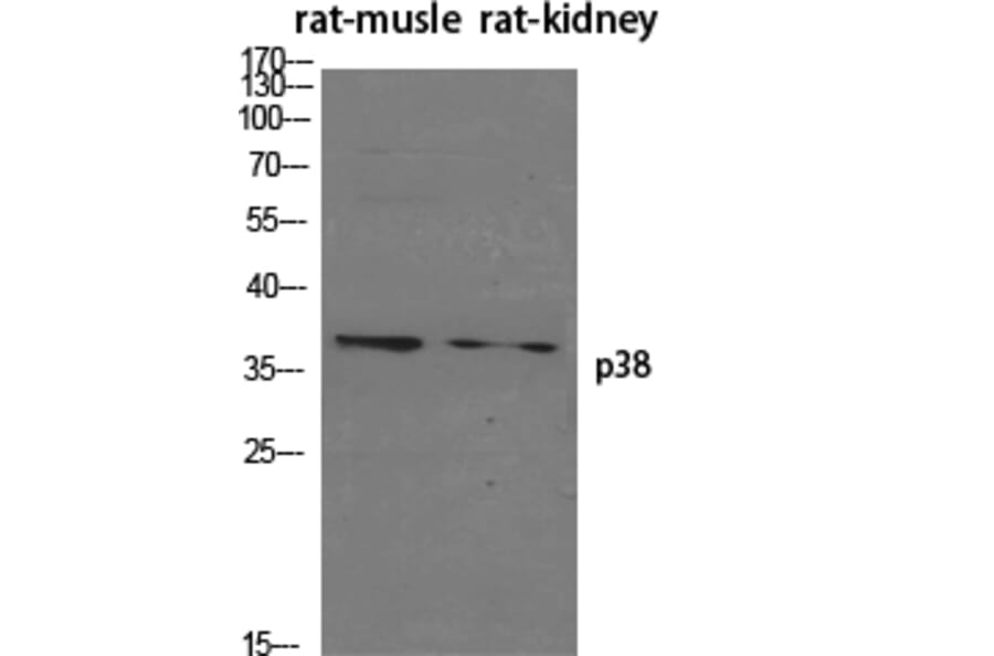 Western blot - p38 Polyclonal Antibody from Signalway Antibody (41306) - Antibodies.com