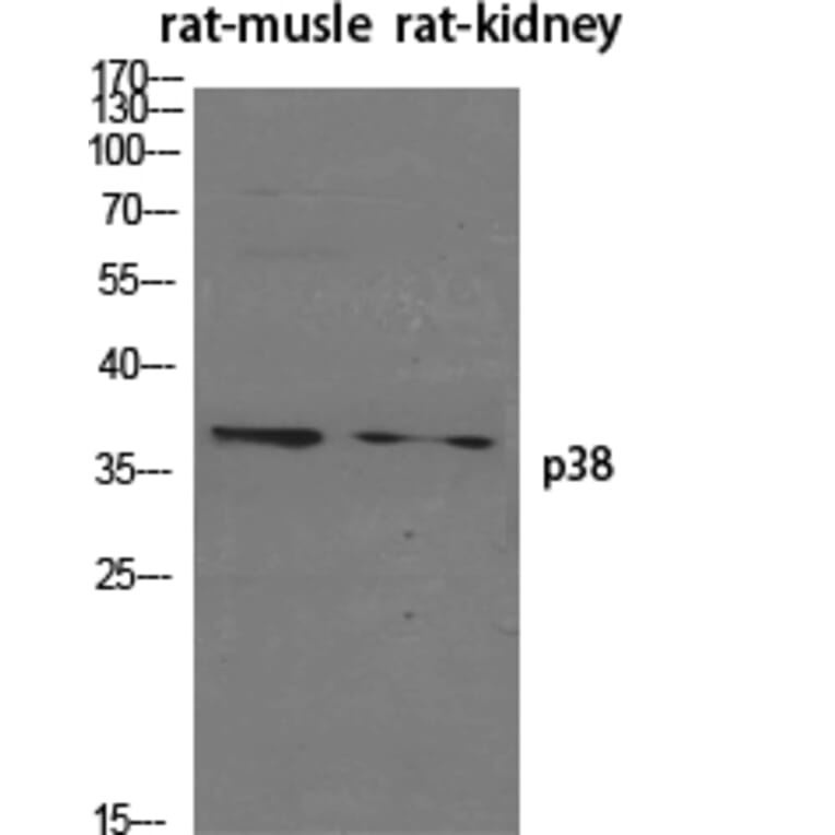 Western blot - p38 Polyclonal Antibody from Signalway Antibody (41306) - Antibodies.com