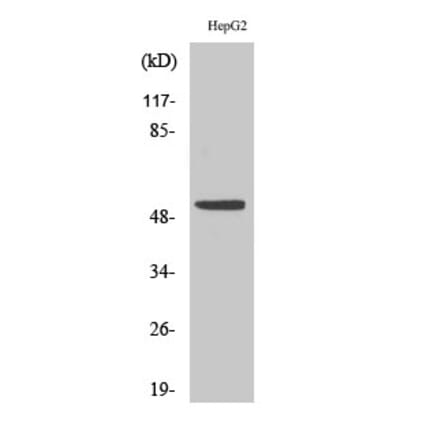 Western blot - p53 Polyclonal Antibody from Signalway Antibody (41307) - Antibodies.com