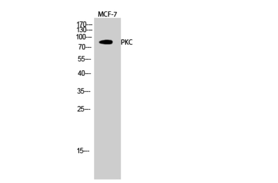 Western blot - PKC Polyclonal Antibody from Signalway Antibody (41347) - Antibodies.com