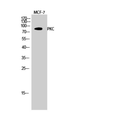 Western blot - PKC Polyclonal Antibody from Signalway Antibody (41347) - Antibodies.com