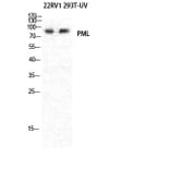 Western blot - PML Polyclonal Antibody from Signalway Antibody (41354) - Antibodies.com