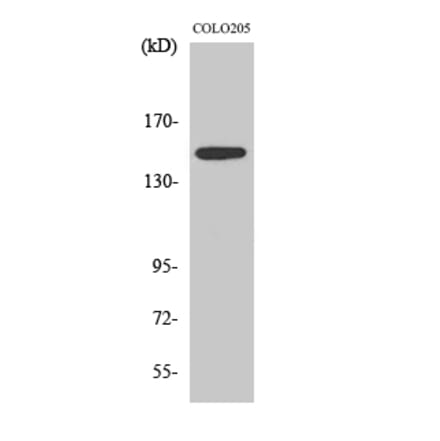 Western blot - SLK Polyclonal Antibody from Signalway Antibody (41439) - Antibodies.com