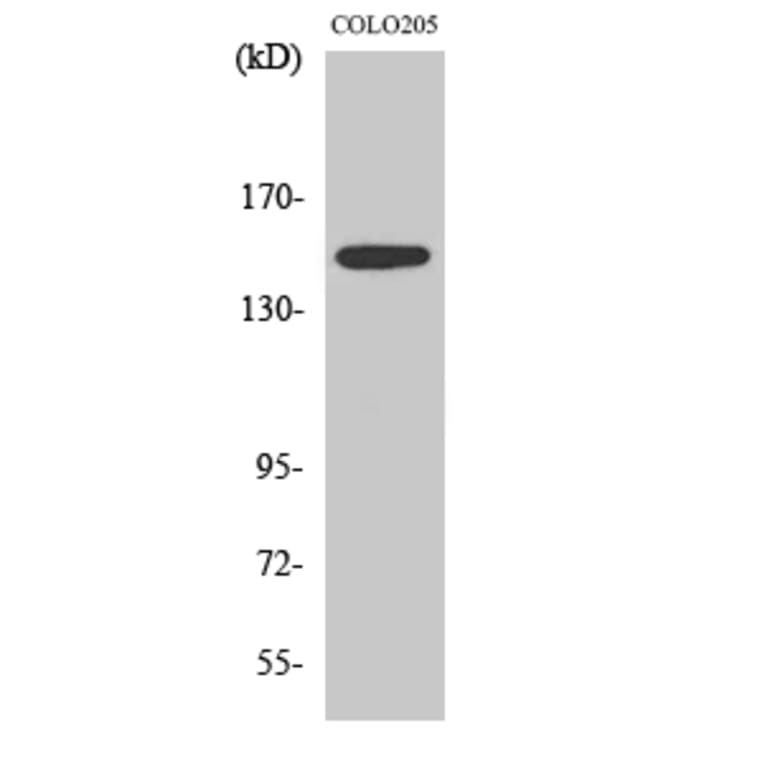 Western blot - SLK Polyclonal Antibody from Signalway Antibody (41439) - Antibodies.com