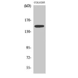 Western blot - SLK Polyclonal Antibody from Signalway Antibody (41439) - Antibodies.com