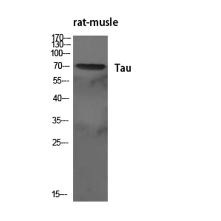 Western blot - Tau Polyclonal Antibody from Signalway Antibody (41480) - Antibodies.com