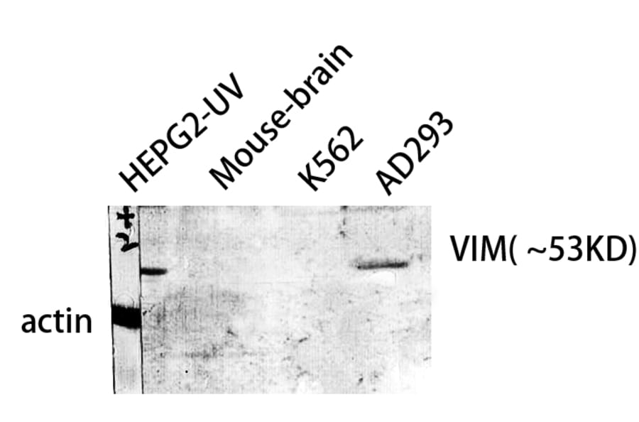 Western blot - VIM Polyclonal Antibody from Signalway Antibody (41531) - Antibodies.com