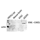 Western blot - VIM Polyclonal Antibody from Signalway Antibody (41531) - Antibodies.com