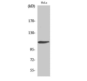 Western blot - Rb Polyclonal Antibody from Signalway Antibody (41389) - Antibodies.com