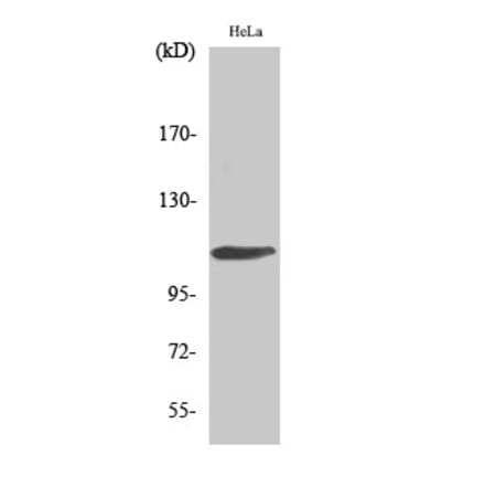 Western blot - Rb Polyclonal Antibody from Signalway Antibody (41389) - Antibodies.com