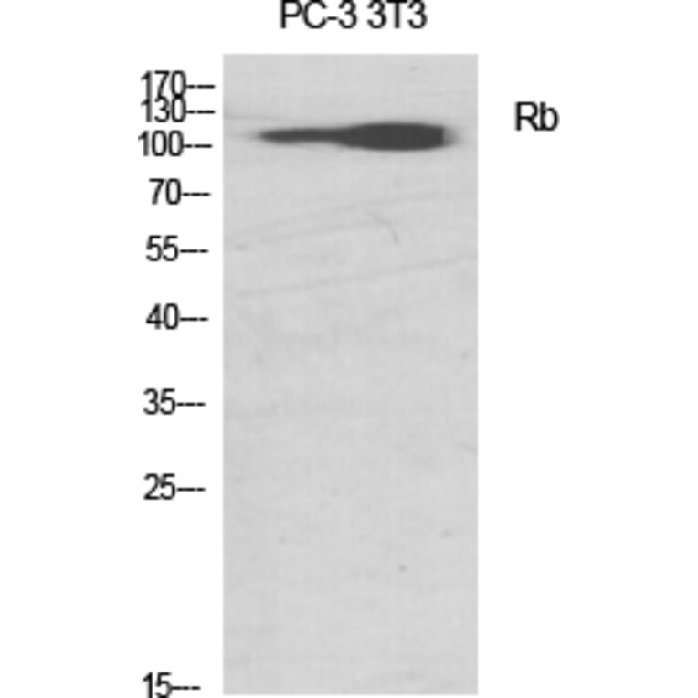 Western blot - Rb Polyclonal Antibody from Signalway Antibody (41389) - Antibodies.com