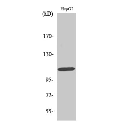 Western blot - Rb Polyclonal Antibody from Signalway Antibody (41390) - Antibodies.com