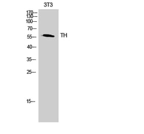 Western blot - TH Polyclonal Antibody from Signalway Antibody (41497) - Antibodies.com