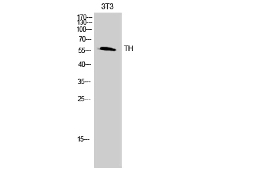 Western blot - TH Polyclonal Antibody from Signalway Antibody (41497) - Antibodies.com