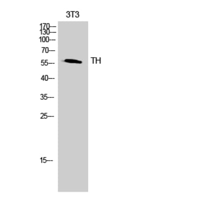 Western blot - TH Polyclonal Antibody from Signalway Antibody (41497) - Antibodies.com
