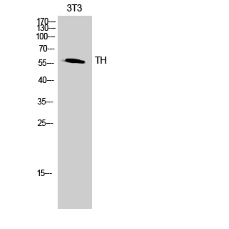 Western blot - TH Polyclonal Antibody from Signalway Antibody (41497) - Antibodies.com