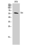 Western blot - TH Polyclonal Antibody from Signalway Antibody (41497) - Antibodies.com