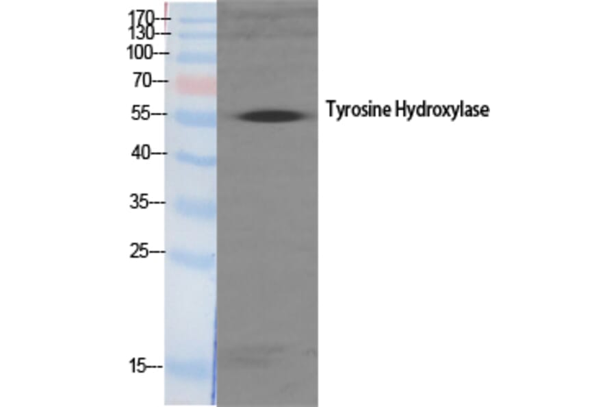 Western blot - TH Polyclonal Antibody from Signalway Antibody (41497) - Antibodies.com