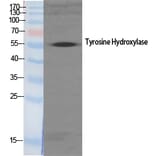 Western blot - TH Polyclonal Antibody from Signalway Antibody (41497) - Antibodies.com