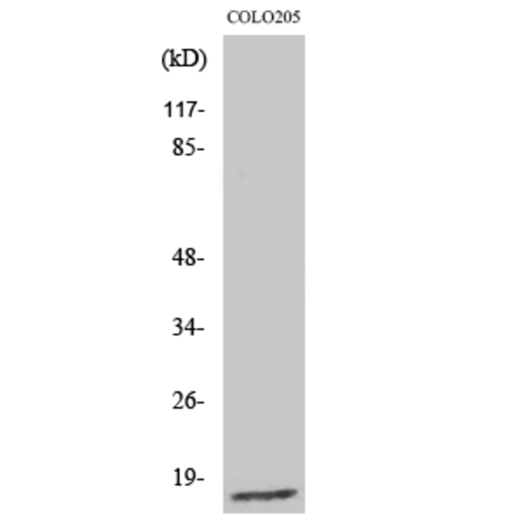 Western blot - Ribosomal Protein L27A Polyclonal Antibody from Signalway Antibody (41404) - Antibodies.com