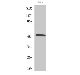 Western blot - Secretin Receptor Polyclonal Antibody from Signalway Antibody (41424) - Antibodies.com