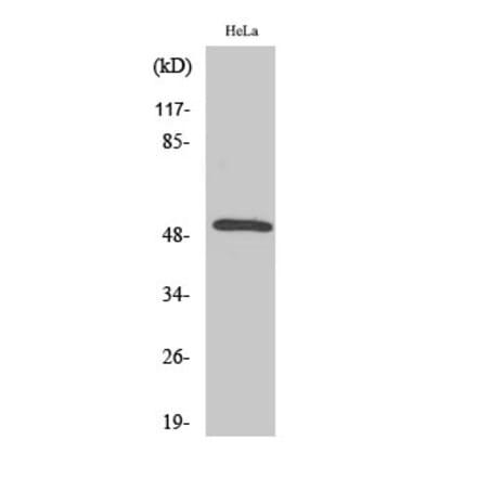 Western blot - Secretin Receptor Polyclonal Antibody from Signalway Antibody (41424) - Antibodies.com