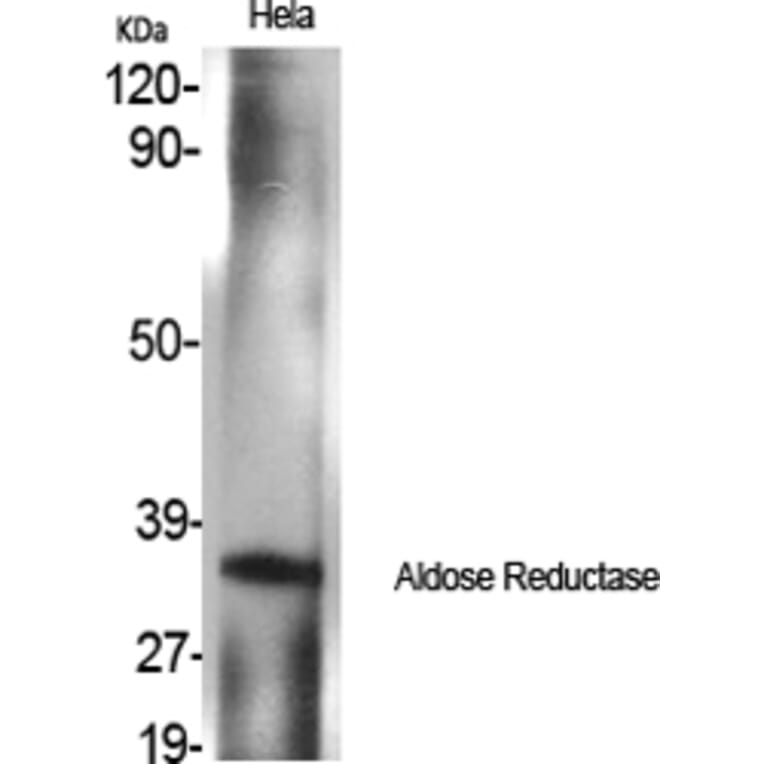 Western blot - Aldose Reductase Polyclonal Antibody from Signalway Antibody (40583) - Antibodies.com