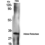 Western blot - Aldose Reductase Polyclonal Antibody from Signalway Antibody (40583) - Antibodies.com