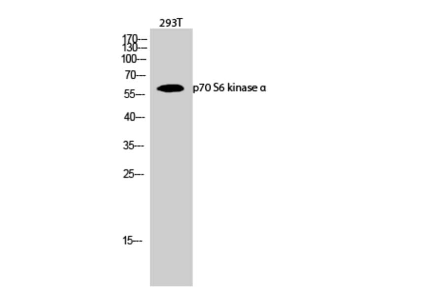 Western blot - p70 S6 kinase α Polyclonal Antibody from Signalway Antibody (41316) - Antibodies.com