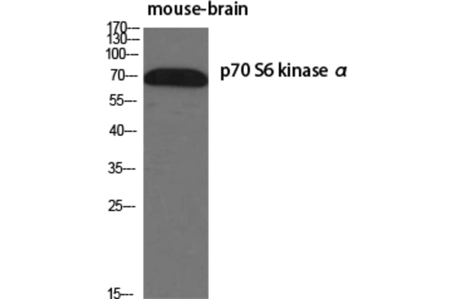 Western blot - p70 S6 kinase α Polyclonal Antibody from Signalway Antibody (41316) - Antibodies.com