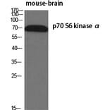 Western blot - p70 S6 kinase α Polyclonal Antibody from Signalway Antibody (41316) - Antibodies.com