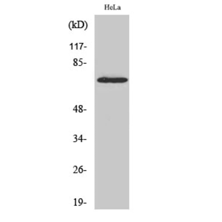 Western blot - p70 S6 kinase α Polyclonal Antibody from Signalway Antibody (41318) - Antibodies.com