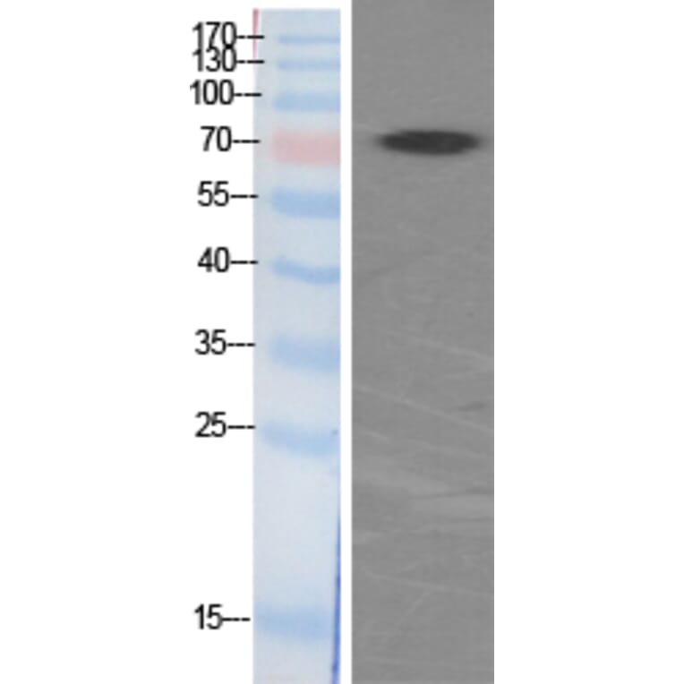 Western blot - p70 S6 kinase α Polyclonal Antibody from Signalway Antibody (41318) - Antibodies.com