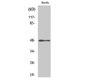 Western blot - Cytokeratin 17 Polyclonal Antibody from Signalway Antibody (40822) - Antibodies.com