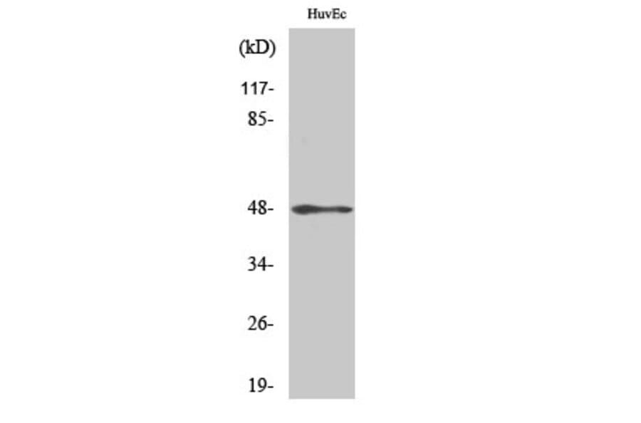 Western blot - Cytokeratin 17 Polyclonal Antibody from Signalway Antibody (40822) - Antibodies.com