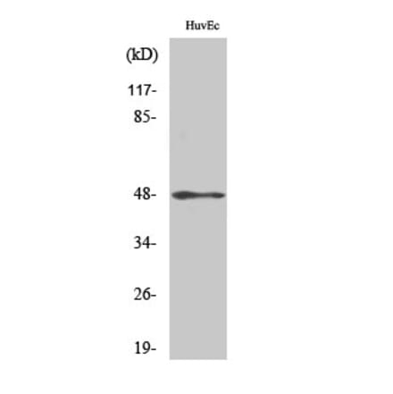 Western blot - Cytokeratin 17 Polyclonal Antibody from Signalway Antibody (40822) - Antibodies.com