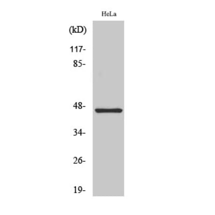Western blot - Cytokeratin 18 Polyclonal Antibody from Signalway Antibody (40824) - Antibodies.com