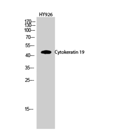 Western blot - Cytokeratin 19 Polyclonal Antibody from Signalway Antibody (40825) - Antibodies.com