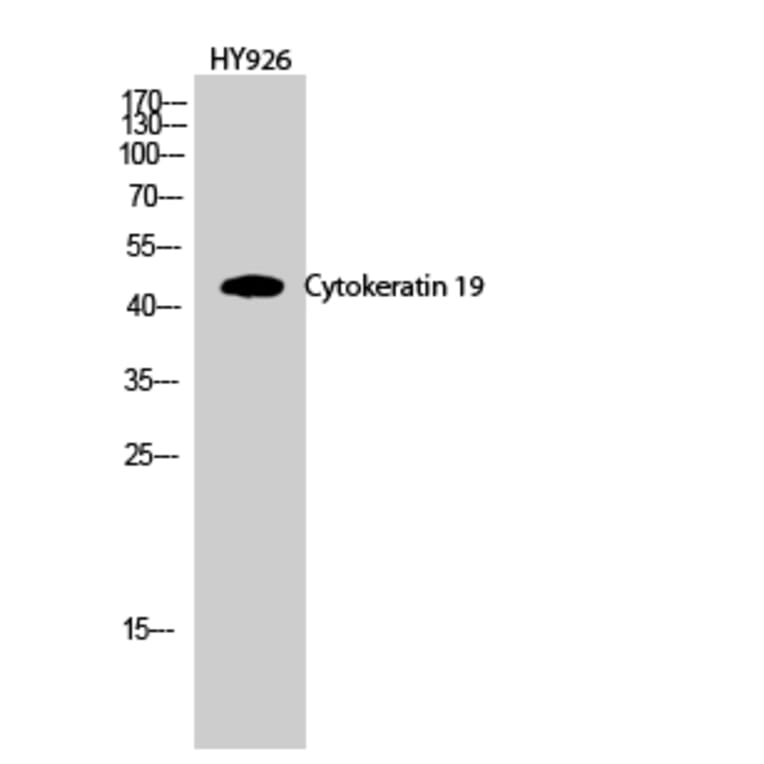 Western blot - Cytokeratin 19 Polyclonal Antibody from Signalway Antibody (40825) - Antibodies.com