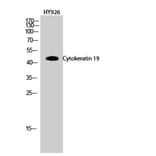 Western blot - Cytokeratin 19 Polyclonal Antibody from Signalway Antibody (40825) - Antibodies.com