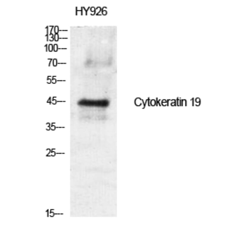 Western blot - Cytokeratin 19 Polyclonal Antibody from Signalway Antibody (40825) - Antibodies.com